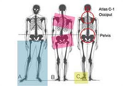 O que é Espondilose cervical
